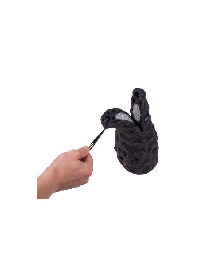 Erler Zimmer, modello anatomico didattico di cancro ai polmoni