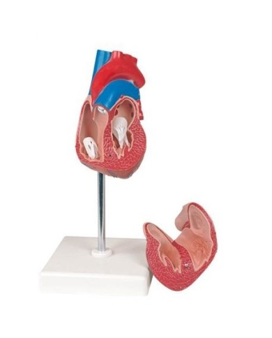 Erler Zimmer, modello anatomico di cuore con ipertrofia, scomponibile in 2 parti G104 Erler Zimmer, modello anatomico di cuore con ipertrofia, scomponibile in 2 parti G104