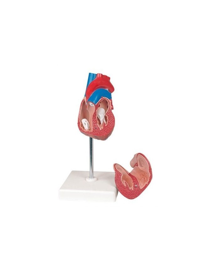 Erler Zimmer, modello anatomico di cuore con ipertrofia, scomponibile in 2 parti G104