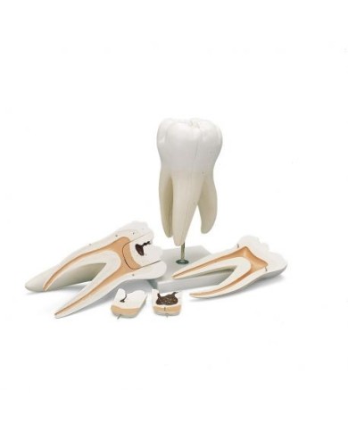 3B Scientific, modello di dente molare superiore a tre radici, in 5 parti  D15
