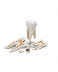 3B Scientific, modello di dente molare superiore a tre radici, in 5 parti  D15
