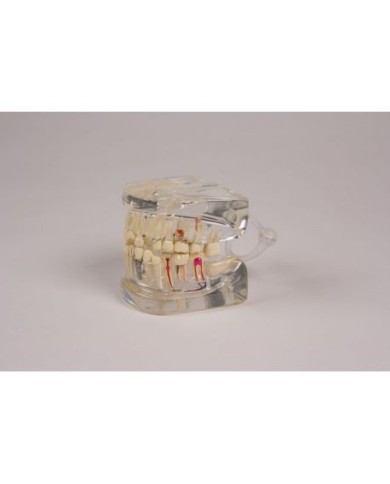 Erler Zimmer, modello anatomico di mandibola trasparente, con denti D19