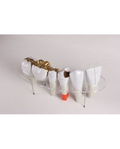 Erler Zimmer, modello anatomico di serie di morfologia dentale,  ingrandito di 10 volte R10125