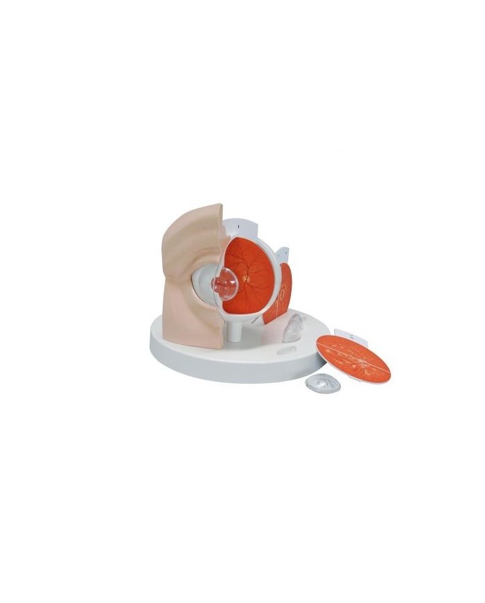 3B Scientific, modello anatomico di occhio patologico, ingrandito di 5 volte F17