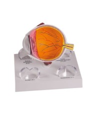 Erler Zimmer,  modello anatomico di occhio, sezione trasversale della cornea F85