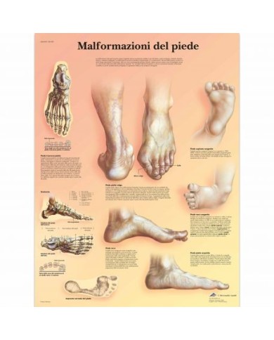 3B Scientific, tavola anatomica, Poster malformazioni di piede VR4185UU 3B Scientific, tavola anatomica, Poster malformazioni di piede VR4185UU