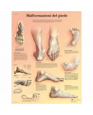 3B Scientific, tavola anatomica, Poster Malformazioni di piede (cod. VR4185L)