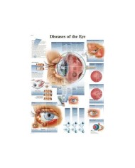 3B Scientific, tavola anatomica, Poster malattie dell'occhio (cod. VR4231UU)