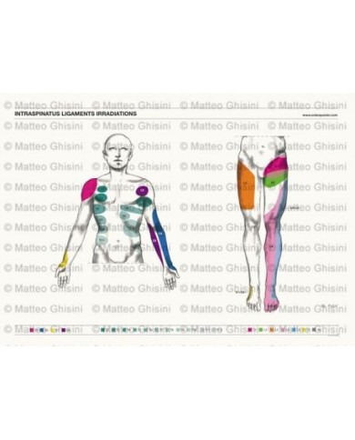 Osteoposter - Irradiazione Legamenti Interspinosi Frontale