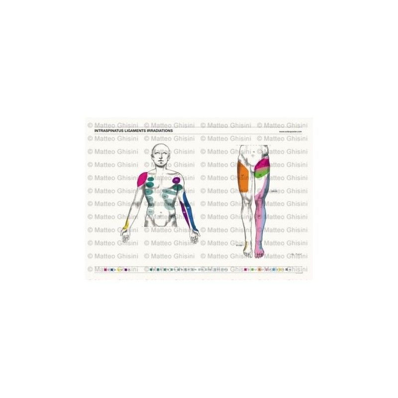 Osteoposter - Irradiazione Legamenti Interspinosi Frontale