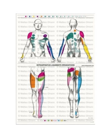 Osteoposter - Irradiazioni Legamenti Interspinosi Verticale