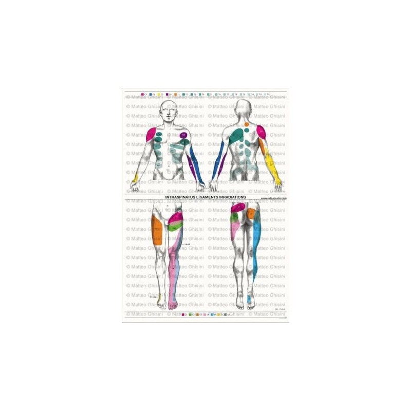 Osteoposter - Irradiazioni Legamenti Interspinosi Verticale