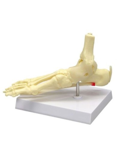 Erler Zimmer, modello anatomico di piede e caviglia - Fascite Plantare 6055 Erler Zimmer, modello anatomico di piede e caviglia - Fascite Plantare 6055