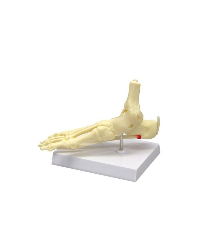 Erler Zimmer, modello anatomico di piede e caviglia - Fascite Plantare 6055