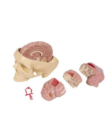 Modello anatomico di malattie del cervello, erler zimmer 4525