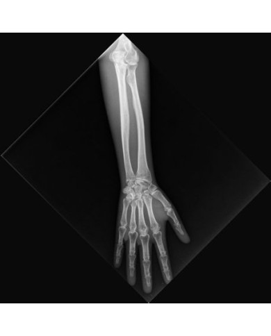 Simulatore per radiologia - Braccio - opaco - Erler Zimmer 7225 Simulatore per radiologia - Braccio - opaco - Erler Zimmer 7225