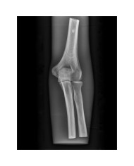 Simulatore per radiologia - Gomito - Trasparente - Erler Zimmer 7260