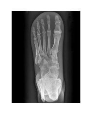 Simulatore per radiologia - Piede - Trasparente - Erler Zimmer 7230 Simulatore per radiologia - Piede - Trasparente - Erler Zimmer 7230