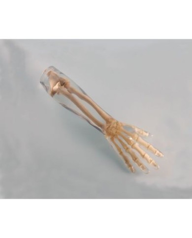 Simulatore per radiologia - Braccio - Trasparente - Erler Zimmer 7220 Simulatore per radiologia - Braccio - Trasparente - Erler Zimmer 7220