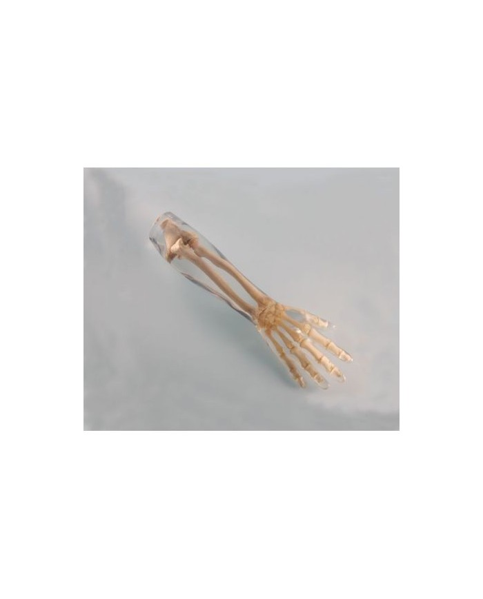 Simulatore per radiologia - Braccio - Trasparente - Erler Zimmer 7220