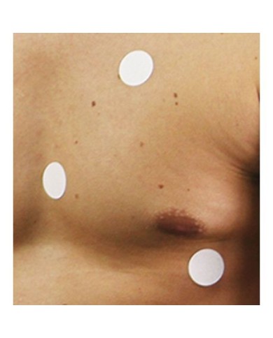 Patch di ricambio per Simulatore di Stetoscopio Elettronico SimScope Erler Zimmer R60005