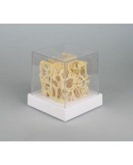 Erler Zimmer, confronto fra modelli di strutture ossee con osteoporosi 4062