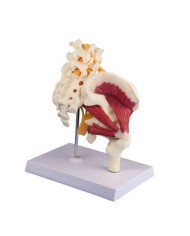 Erler Zimmer, modellino anatomico di articolazione dell'anca, con muscoli e nervo sciatico 4049