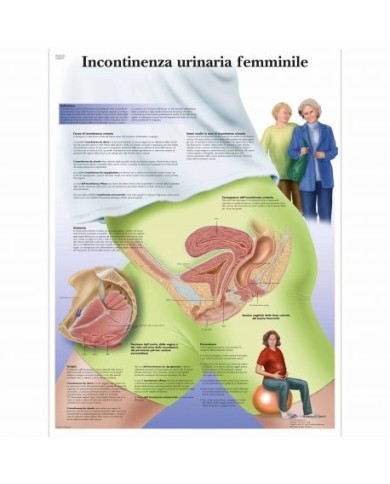 3B Scientific, tavola anatomica, Incontinenza urinaria femminile (cod,VR4542UU  ) 3B Scientific, tavola anatomica, Incontinenza urinaria femminile (cod,VR4542UU  )