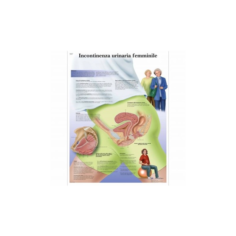 3B Scientific, tavola anatomica, Incontinenza urinaria femminile (cod,VR4542UU  )