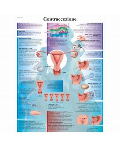 3B Scientific, tavola anatomica, TA Contraccezione (cod, VR4591UU ) 3B Scientific, tavola anatomica, TA Contraccezione (cod, VR4591UU )