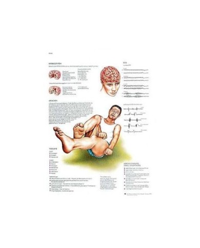 3B Scientific, tavola anatomica, Poster Epilessia cod. VR4626L 3B Scientific, tavola anatomica, Poster Epilessia cod. VR4626L