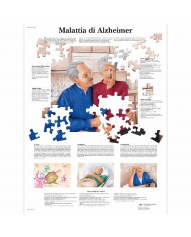 3B Scientific, tavola anatomica, Poster Malattia di Alzheimer cod. VR4628UU 3B Scientific, tavola anatomica, Poster Malattia di Alzheimer cod. VR4628UU