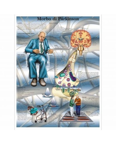 3B Scientific, tavola anatomica, Poster Morbo di Parkinson cod. VR4629UU 3B Scientific, tavola anatomica, Poster Morbo di Parkinson cod. VR4629UU