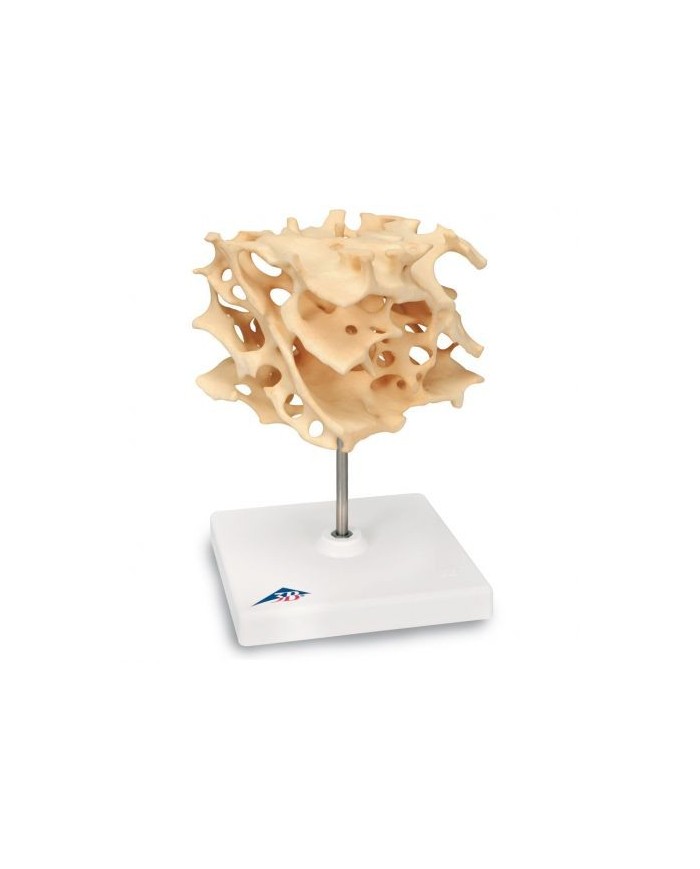 3B Scientific, MICROanatomy, sostanza spugnosa A99