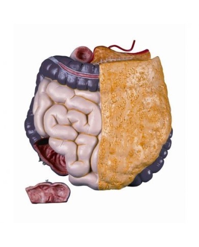 Intestino di ricambio, in due parti XB016