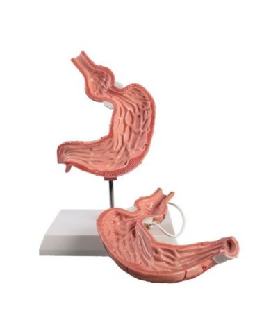 Erler Zimmer, modello anatomico di stomaco umano con bendaggio gastrico K82