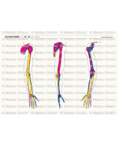 Osteoposter - Sclerotomi Braccia