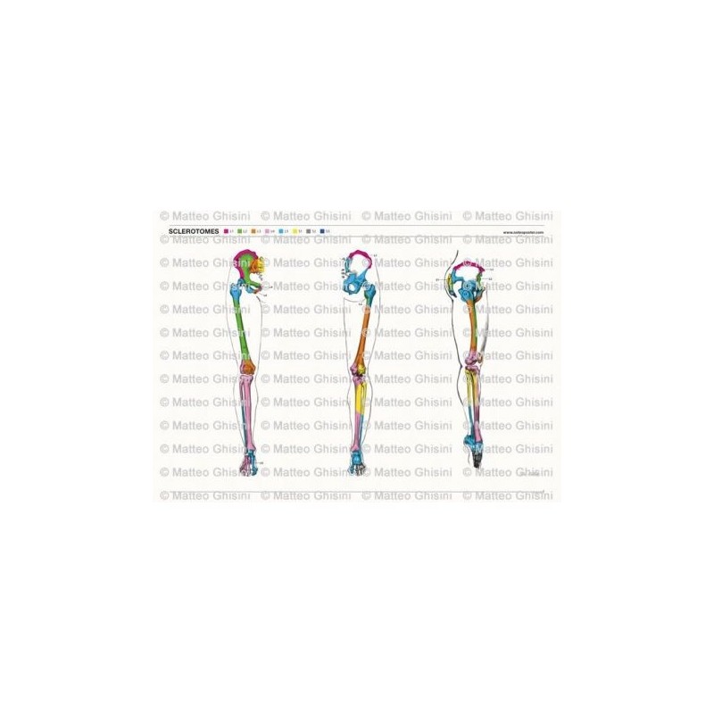 Osteoposter - Sclerotomi Gambe