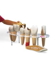 3B Scientific, modello anatomico di protesi dentaria, ingrandito 10 volte, in 7 parti W42517