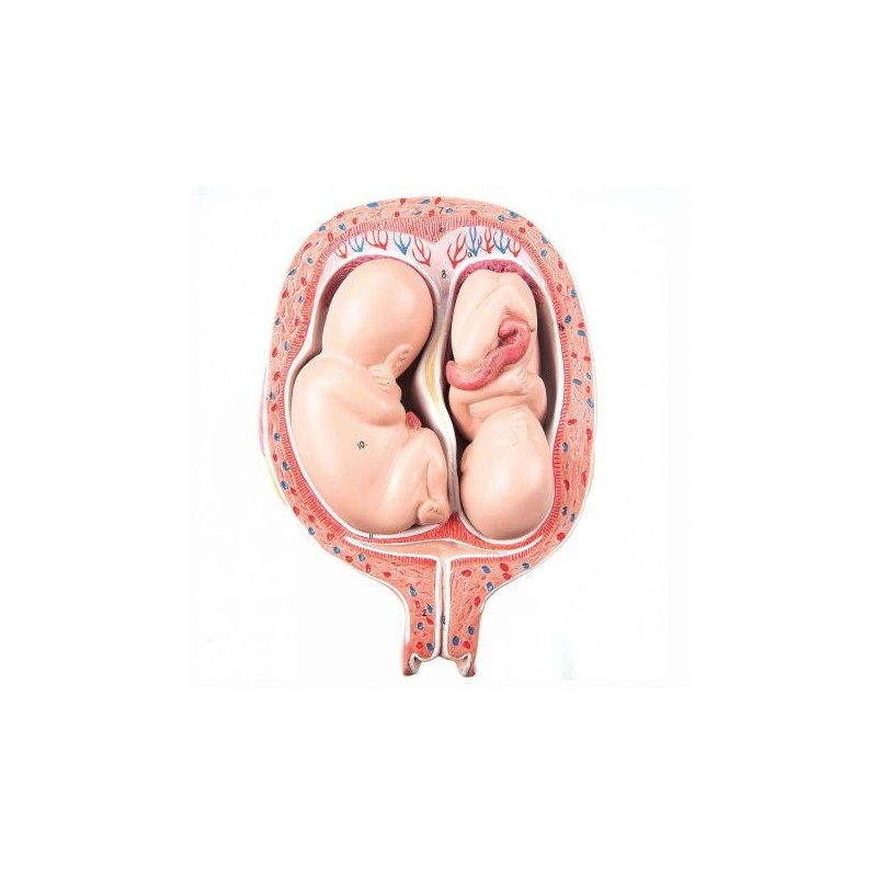3B Scientific, Modello di Embrioni di feti gemelli al 5° Mese, posizione normale L10/7