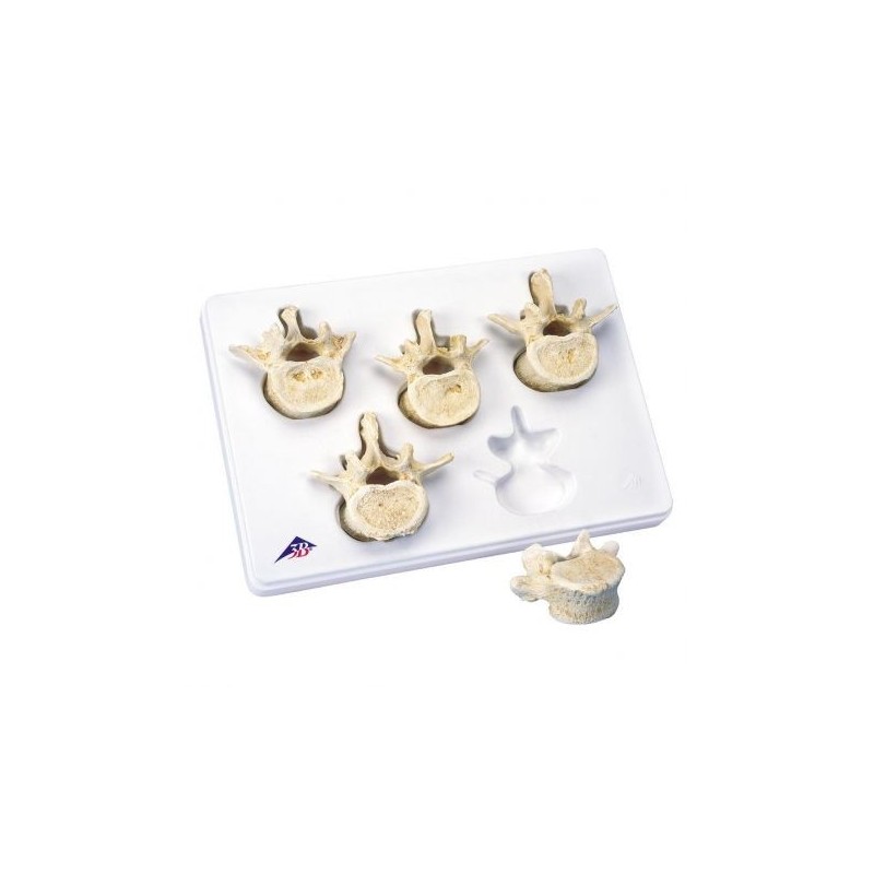 3B Scientific, Set con 5 vertebre lombari 3B BONElike™ A792
