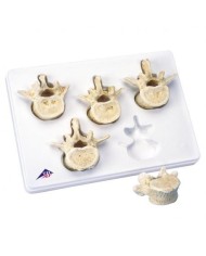 3B Scientific, Set con 5 vertebre lombari 3B BONElike™ A792