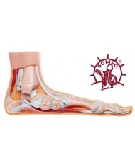 Piede Piatto - Modello anatomico SOMSO NS2