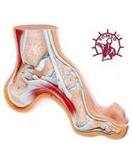 Piede Cavo - Modello anatomico SOMSO NS3