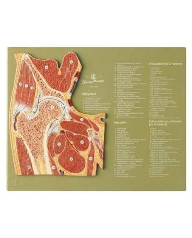 Articolazione dell'anca in sezione sagittale - Modello anatomico SOMSO NS44 Articolazione dell'anca in sezione sagittale - Modello anatomico SOMSO NS44