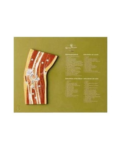 Articolazione del gomito in sezione sagittale - Modello anatomico SOMSO NS46