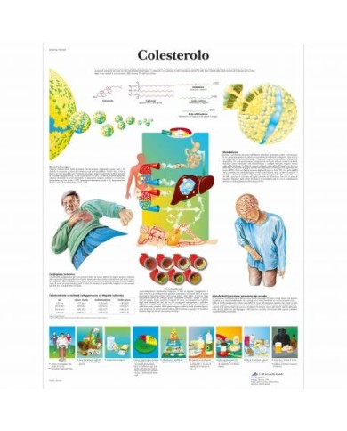 3B Scientific, tavola anatomica, Colesterolo (cod, VR4452UU) 3B Scientific, tavola anatomica, Colesterolo (cod, VR4452UU)