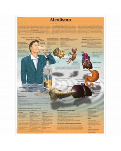 3B Scientific, tavola anatomica, Alcolismo (cod, VR4792UU) 3B Scientific, tavola anatomica, Alcolismo (cod, VR4792UU)