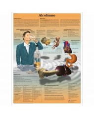 3B Scientific, tavola anatomica, Alcolismo (cod, VR4792UU)