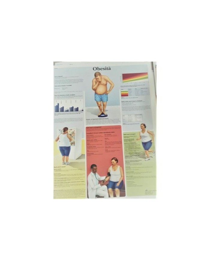 3B Scientific, tavola anatomica,  Obesità (cod, VR4460UU)